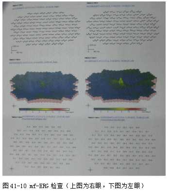 ZY016_227_2.gif